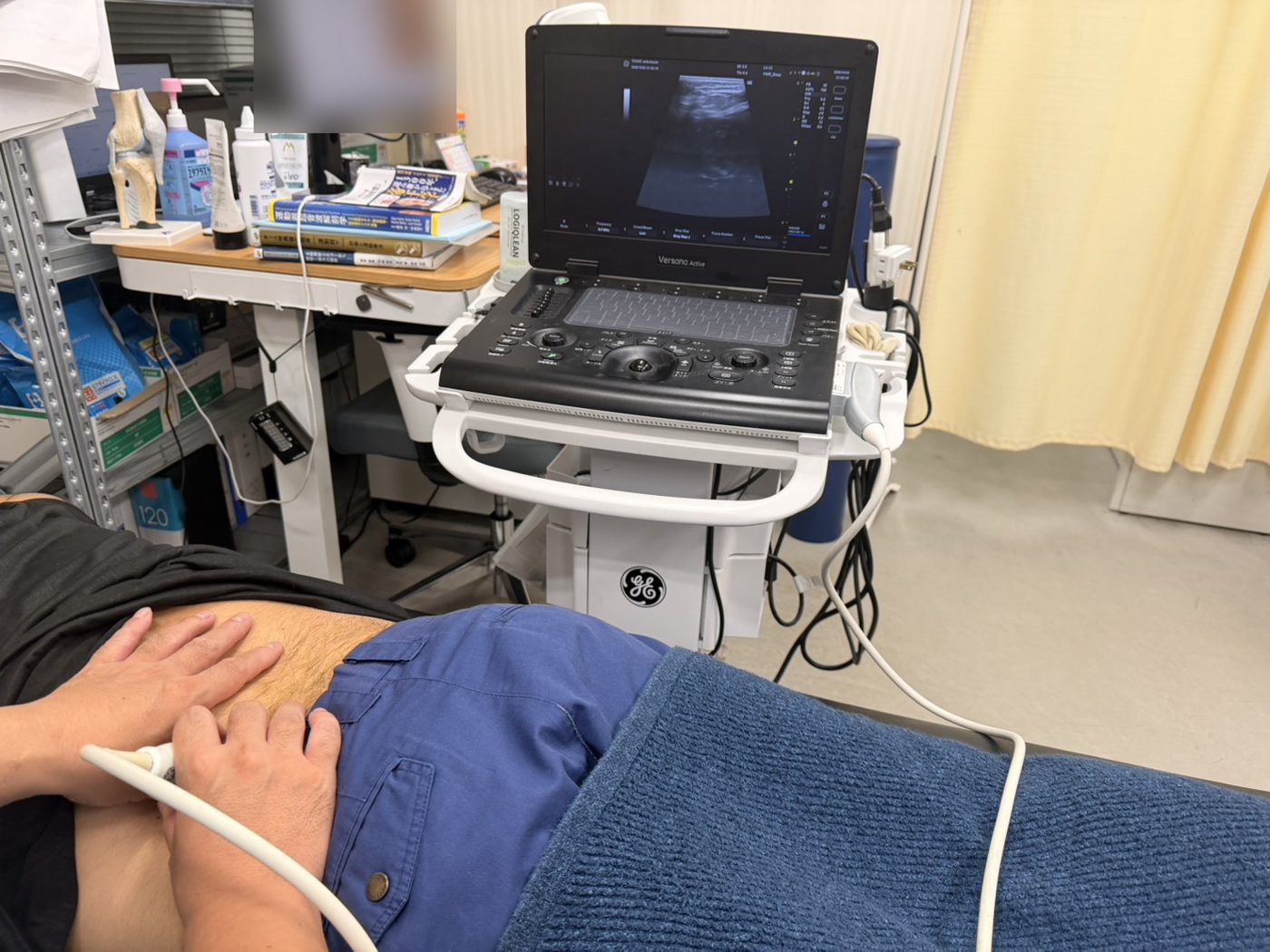 横向きに寝た方の腰・お尻まわりに、施術者が超音波エコーのプローブを当てている。奥のエコー装置の画面に画像が映っている